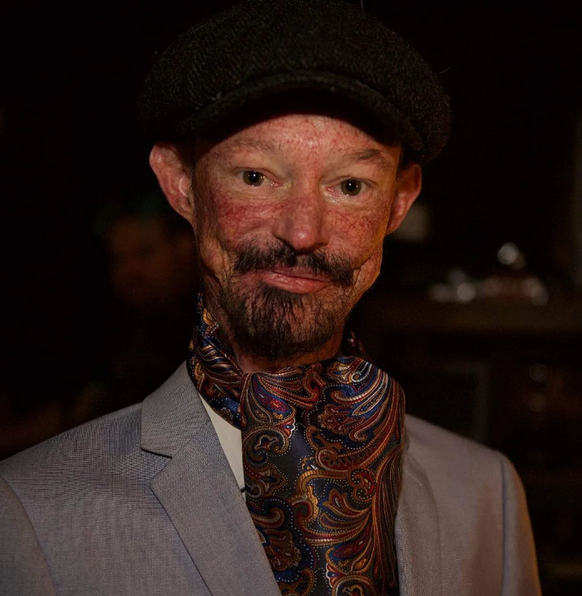 Darren Kent