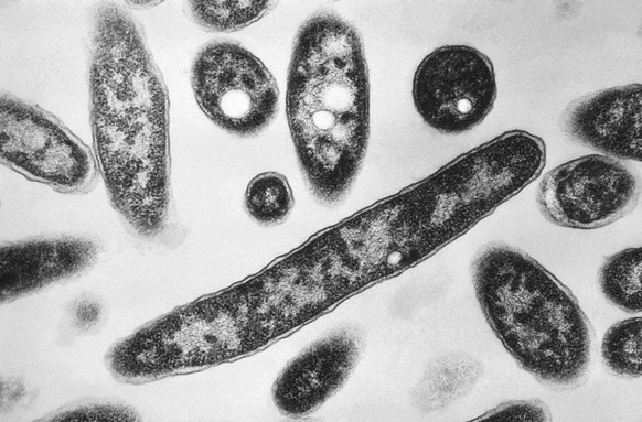 FILE - This 1978 electron microscope image made available by the Centers for Disease Control and Prevention shows Legionella pneumophila bacteria which are responsible for causing the pneumonic diseas ...
