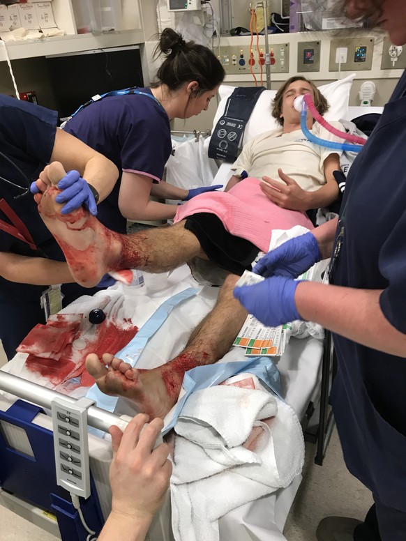 epa06129746 A handout photo made available by Jarrod Kanizay, the father of 16-year-old Sam Kanizay, on 07 August 2017, shows Sam Kanizay receiving treatment in a Melbourne Hospital after sustaining s ...