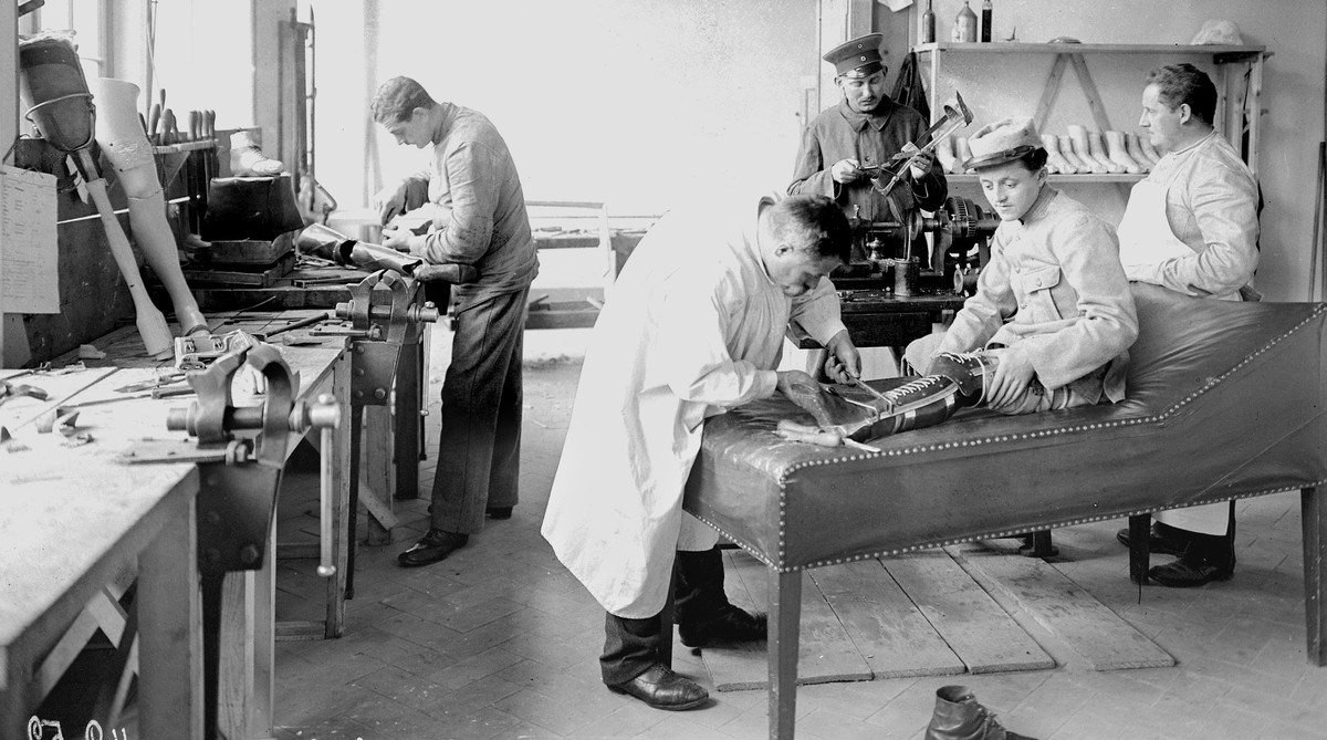 In einer Anstalt in der Schweiz passt ein Arzt einem französischen Kriegsgefangenen eine Beinprothese an. Über 12'000 ausländische Armeeangehörige, darunter Franzosen, Engländer, Belgier und Deut ...