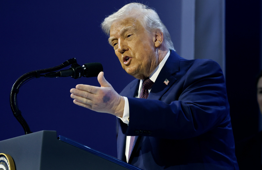 Donald Trump Bluterguss Hand WEF