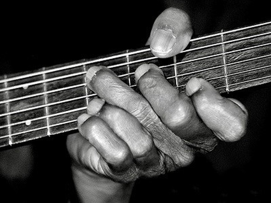 Hounddog Taylor – the six fingered guitarist. Chicago, 1972
https://www.facebook.com/BobCorritore/posts/hound-dog-taylor-and-dog-photo-peter-amft/1338389304310124/