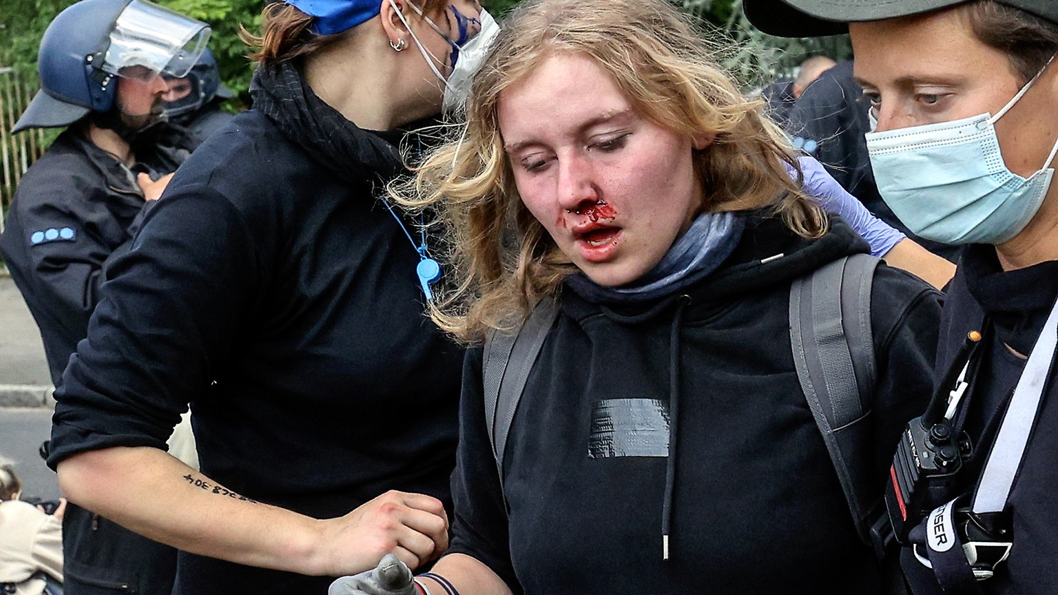 epa11331043 A protester is seen bleeding as police officers restrain environmental activists during a protest against Tesla&#039;s plans to extend its Gigafactory plant, in Gruenheide, near Berlin, Ge ...