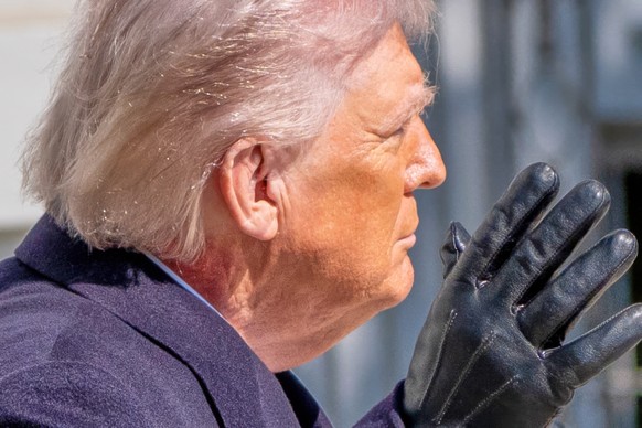 Redness is visible on the neck of President Donald Trump waves as he walks to depart on Marine One from the South Lawn of the White House, Friday, Feb. 27, 2026, in Washington. (AP Photo/Alex Brandon) ...