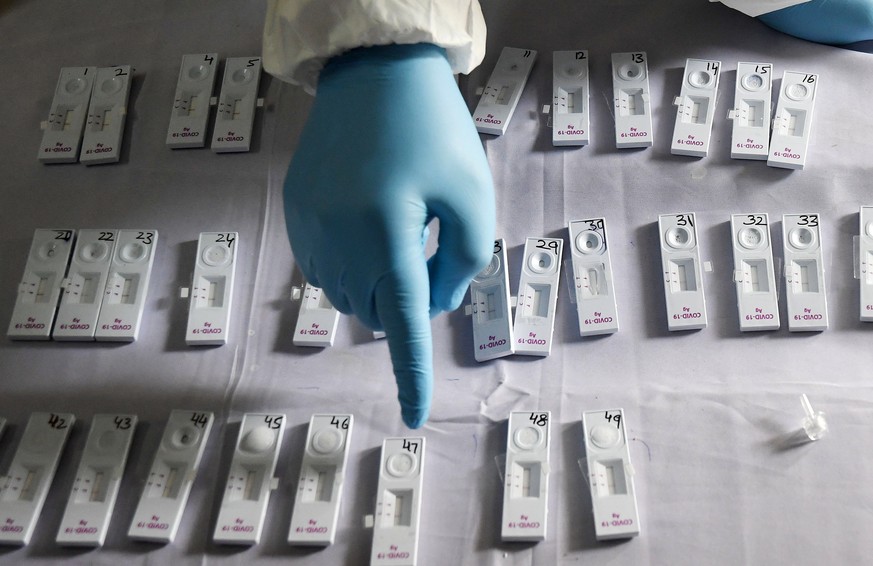 epaselect epa08688272 An Indian Health worker checks the results for the coronavirus COVID-19 Rapid Antigen detection testing in New Delhi, India, 22 September 2020. I?ndia has the second highest tota ...