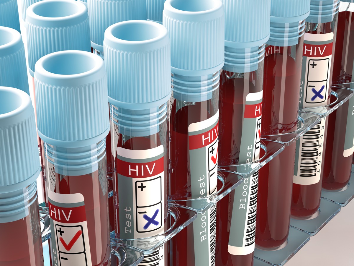 HIV Test