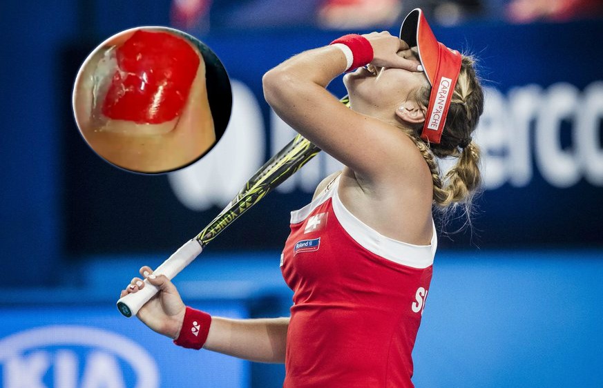 Belinda Bencic macht der grosse Zehennagel zu schaffen.