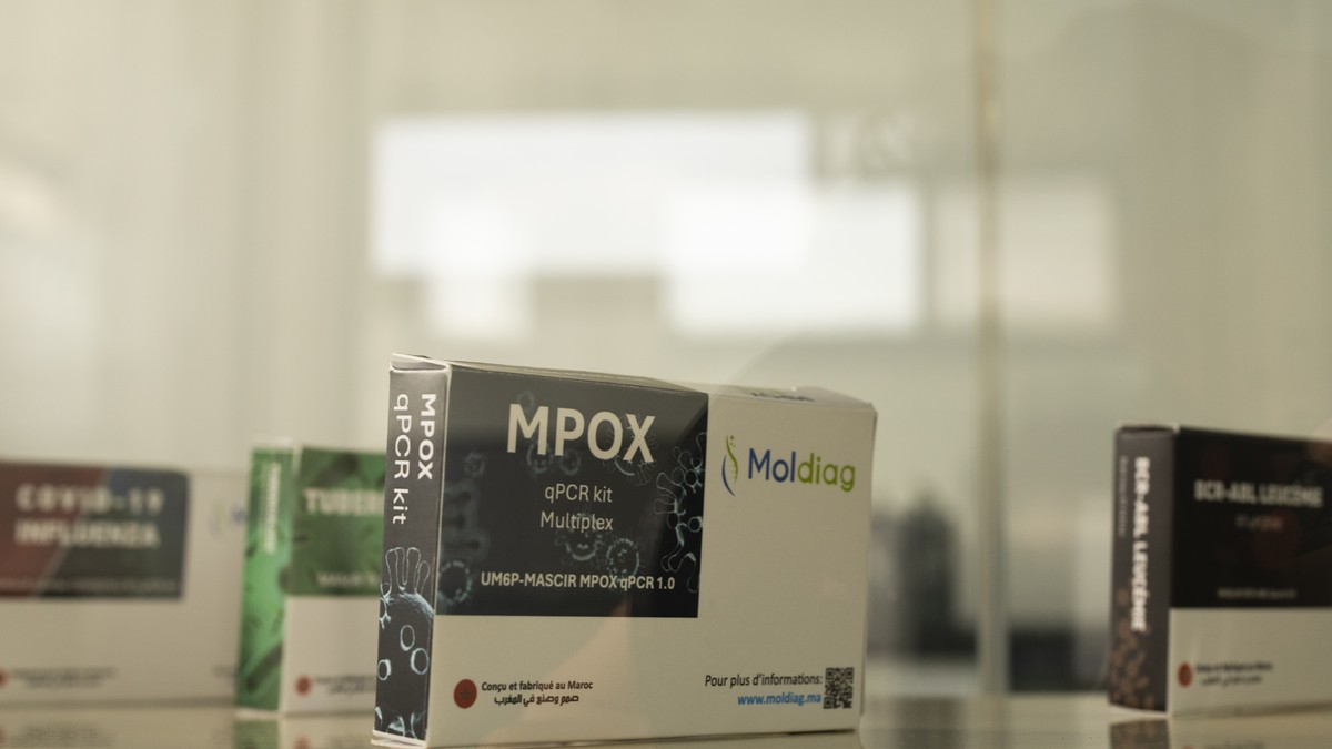Das-Mpox-Virus-kann-laut-einer-neuen-Studie-auch-das-Hirn-befallen