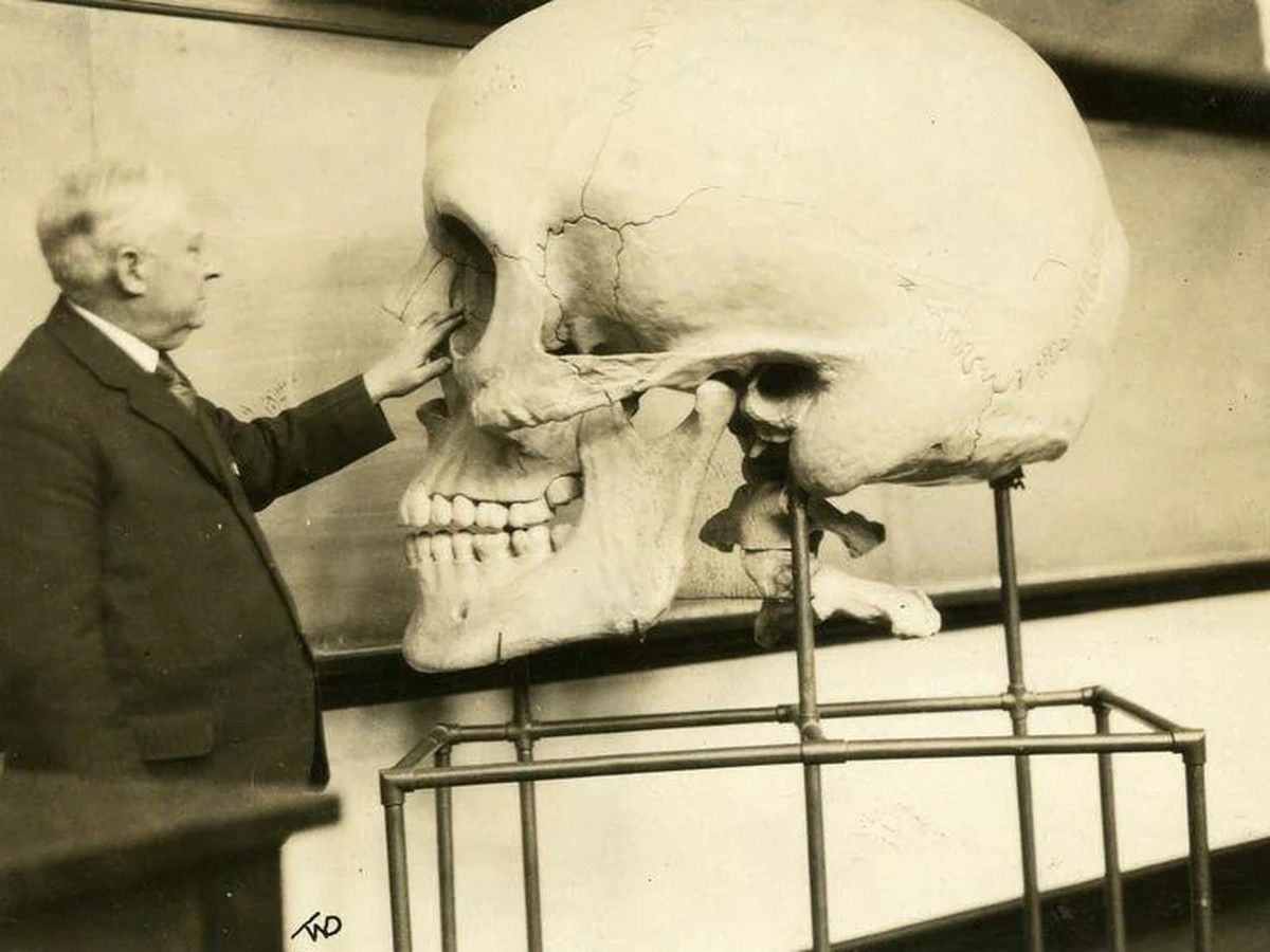 Harris P. Mosher teaching at Harvard Medical School in 1929. This giant skull was made in the 1890s. [736x552]