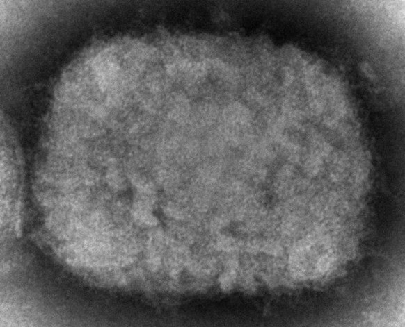 This 2003 electron microscope image made available by the Centers for Disease Control and Prevention shows a monkeypox virion, obtained from a sample associated with the 2003 prairie dog outbreak. Mon ...