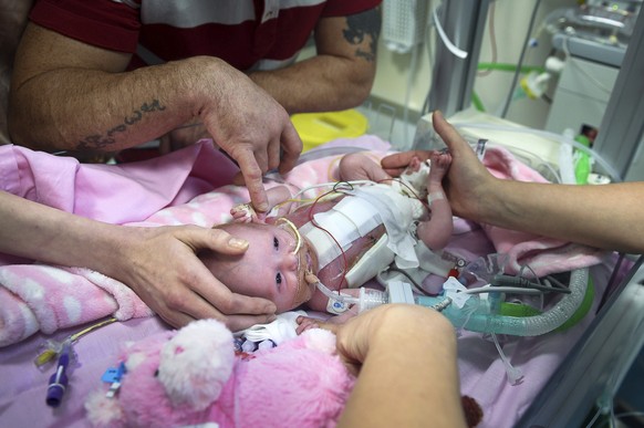 Three-week-old Vanellope Hope Wilkins who was born with an extremely rare condition in which the heart grows on the outside of the body, at Glenfield Hospital in Leicester, Monday Dec. 11, 2017. (Ben  ...