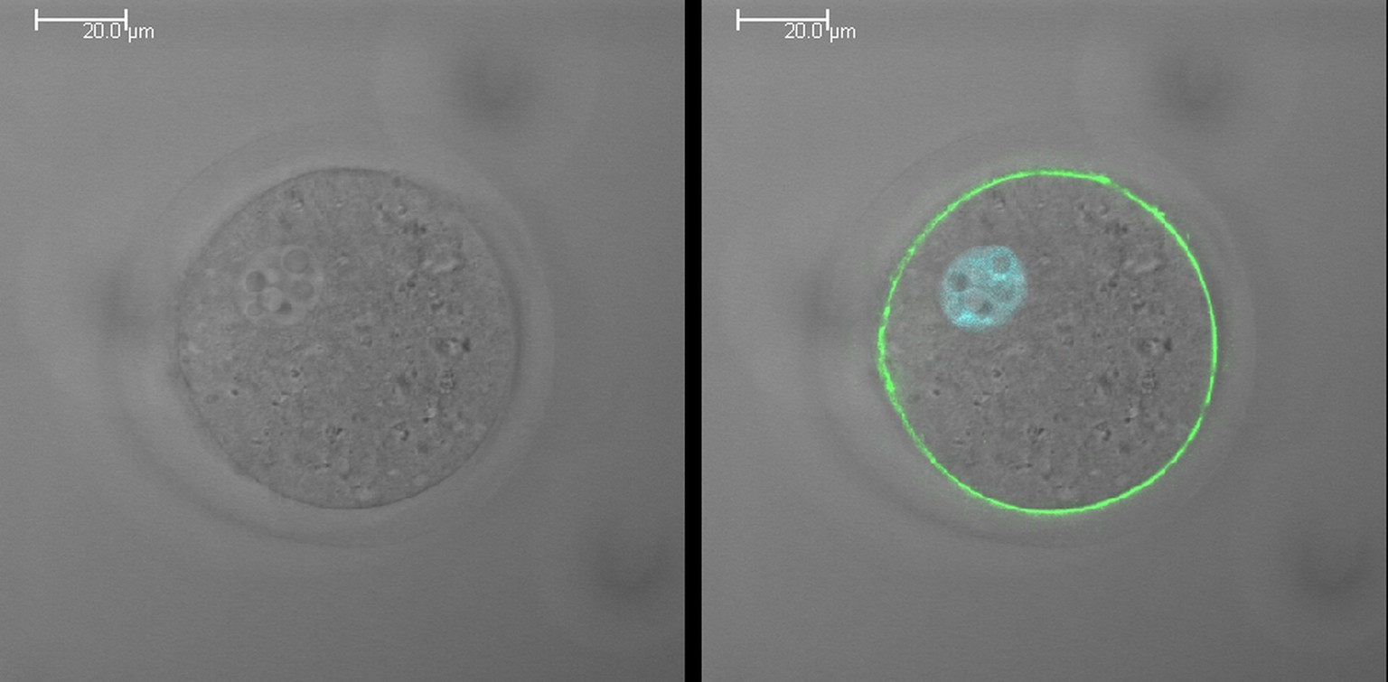 Das Protein «Juno» erscheint grün auf der Eizelle (rechts).