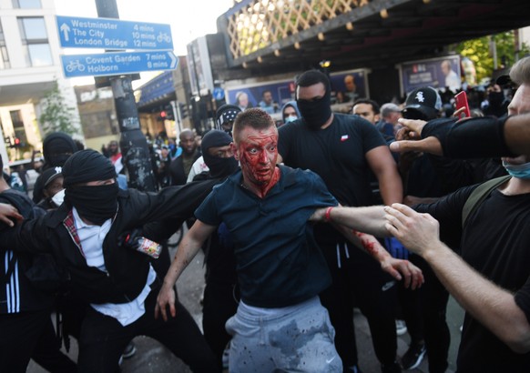 epaselect epa08483442 An injured counter-protester outside Waterloo station during a Black Lives Matter (BLM) demonstration in London, Britain, 13 June 2020. Protesters gathered to express their feeli ...