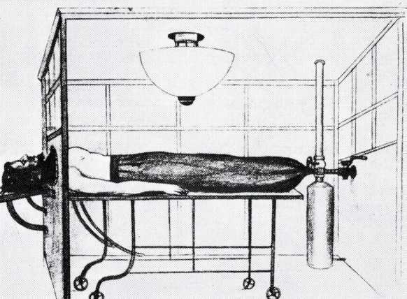 Sauerbruchs und Mikuliczs Unterdruckkammer (1904).