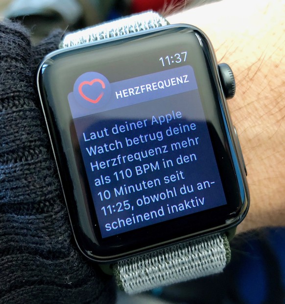 Der Puls-Schwellenwert lässt sich in der Apple-Watch-App auf dem iPhone festlegen.
