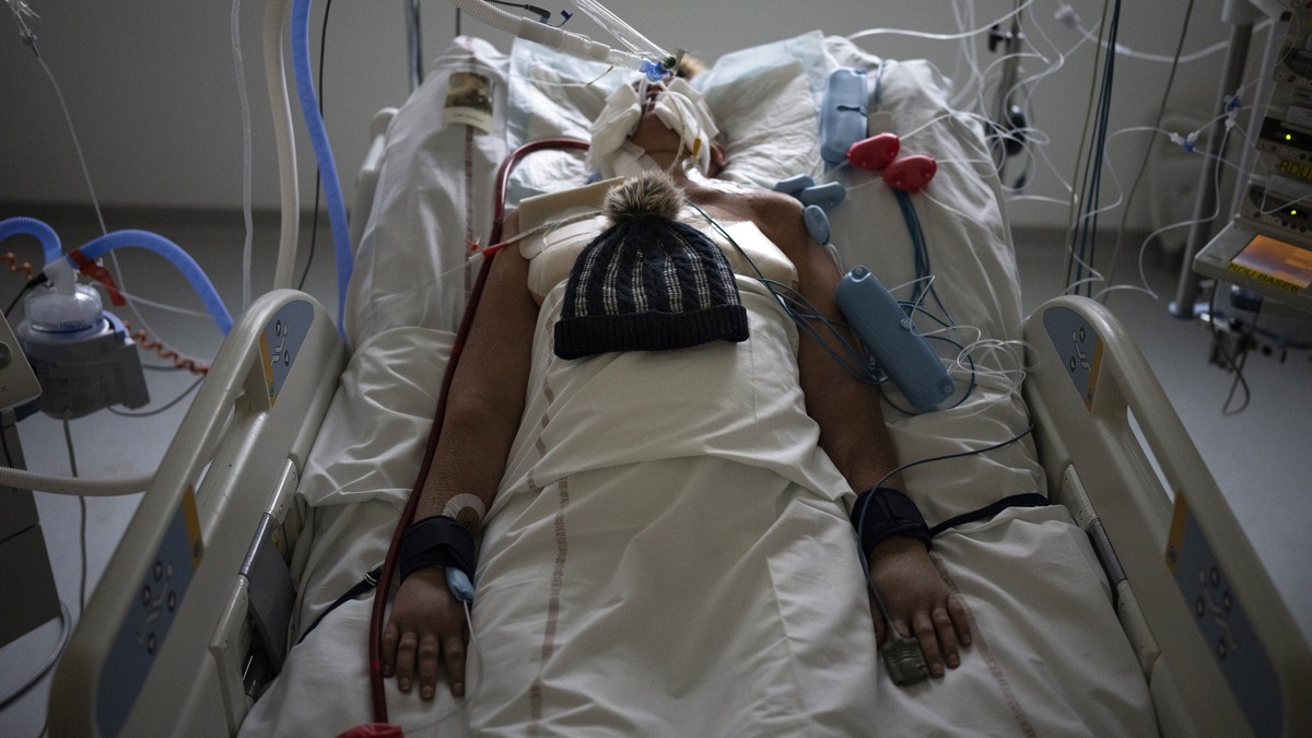 FILE - A patient with COVID-19 lies on a bed with a ventilator in the intensive care unit at the la Timone hospital in Marseille, southern France, Thursday, Dec. 23, 2021. The World Health Organizatio ...