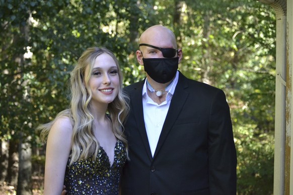 This family photo shows Aaron James and his daughter, Allie in September 2022. Aaron was working for a power line company in June 2021 when he was shocked by a live wire. He nearly died. Ultimately he ...