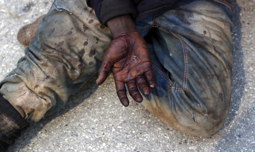 A man shows the injures on his hand as he sits on the ground after storming a fence to enter the Spanish enclave of Ceuta, Spain, Friday, Feb. 17, 2017. An emergency team in Ceuta is assisting more th ...