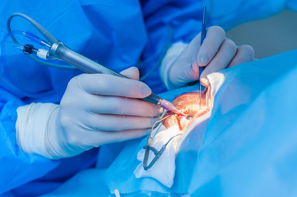 Augenoperation