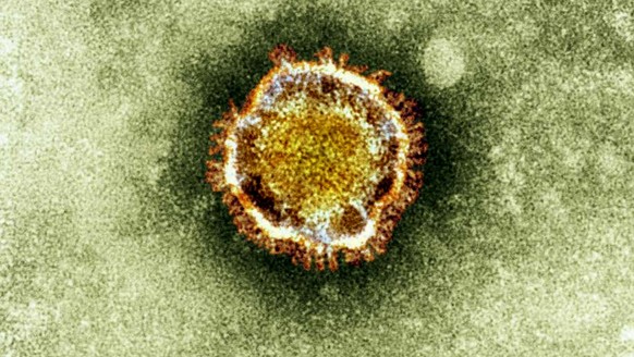 FILE - In this undated file image released by the British Health Protection Agency shows an electron microscope image of a coronavirus, part of a family of viruses that cause ailments including the co ...
