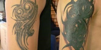 Wenn misslungene Tattoos nach der «Rettung» noch schlimmer aussehen als vorher