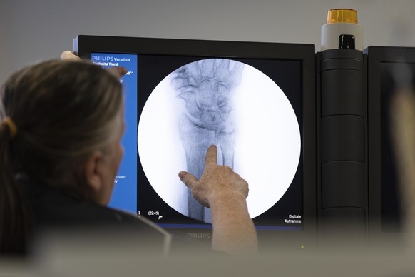 [Staged Picture, Gestellte Szene] A nurse shows a patient (not in the picture) a radiograph, pictured at the Triemli Hospital in Zurich, Switzerland, on November 28, 2018. (KEYSTONE/Gaetan Bally)