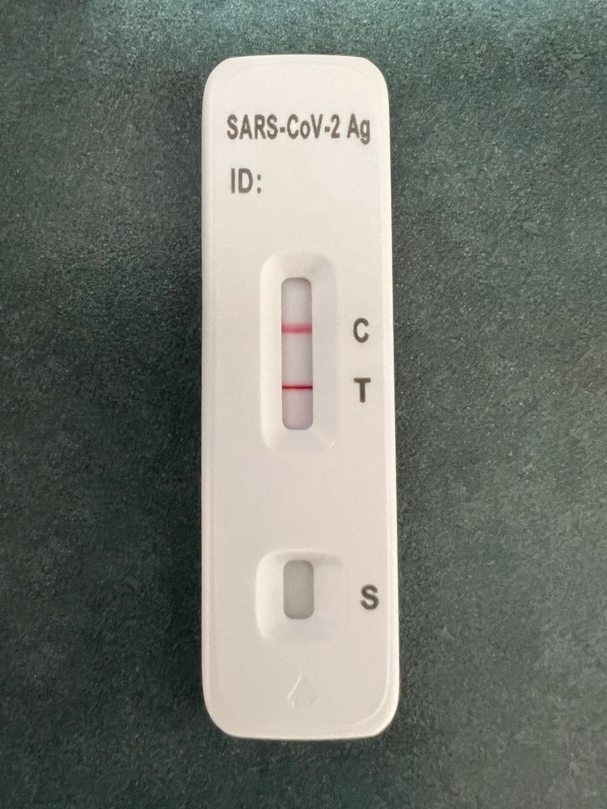 A positive COVID-19 rapid test is being shown at a doctor&amp;#039;s office in Toronto, Ontario, Canada, on July 23, 2024. COVID-19 numbers are spiking across Ontario this summer as the new COVID-19 v ...