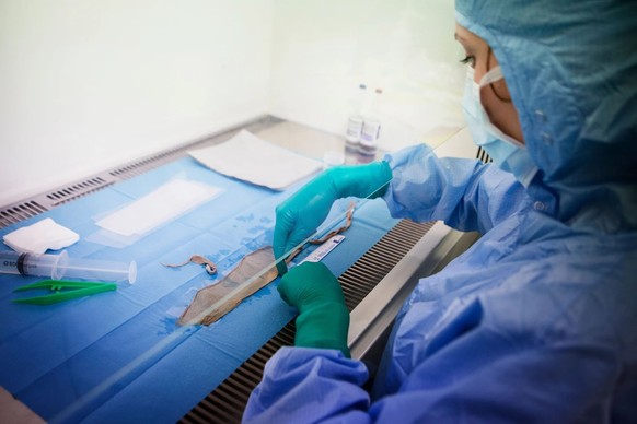 Spenderhaut aus Gewebebanken dient als vorübergehender Schutz, bis genügend Eigenhaut gezüchtet ist.