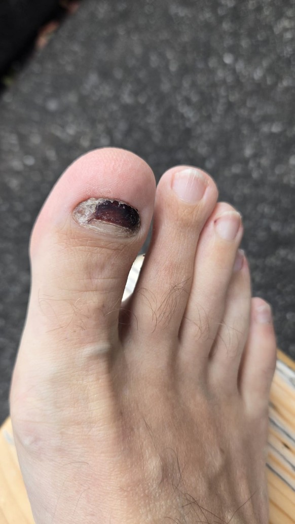 Flipflop oder nicht? das sind die schönsten Watson Füsse