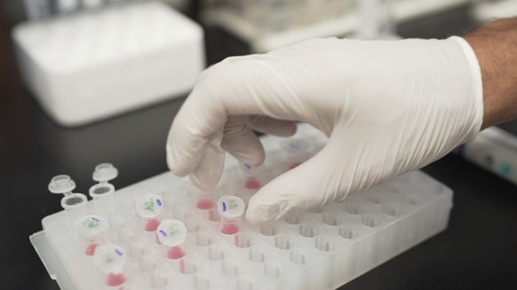 Previous Alzheimer's drugs can have a variety of side effects.