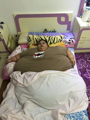 epa05676484 An undated family handout picture released on 15 December 2016 showing Egyptian woman, Eman Ahmed, who is believed to be world&#039;s heaviest woman, at her home in Alexandria, Egypt. Acco ...