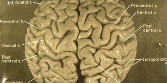 Der Pathologe, der Einsteins Gehirn stahl