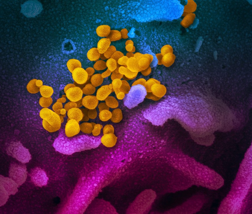 Novel Coronavirus SARS-CoV-2 This scanning electron microscope image shows SARS-CoV-2 (yellow)—also known as 2019-nCoV, the virus that causes COVID-19—isolated from a patient in the U.S., emerging fro ...