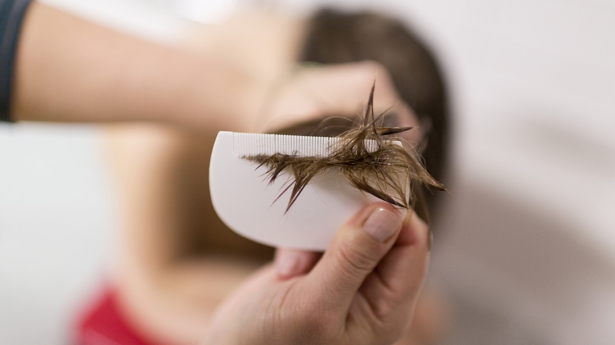 A mother uses a lice comb on her daughter's hair, pictured in Zurich, Switzerland, on February 25, 2014. (KEYSTONE/Gaetan Bally)